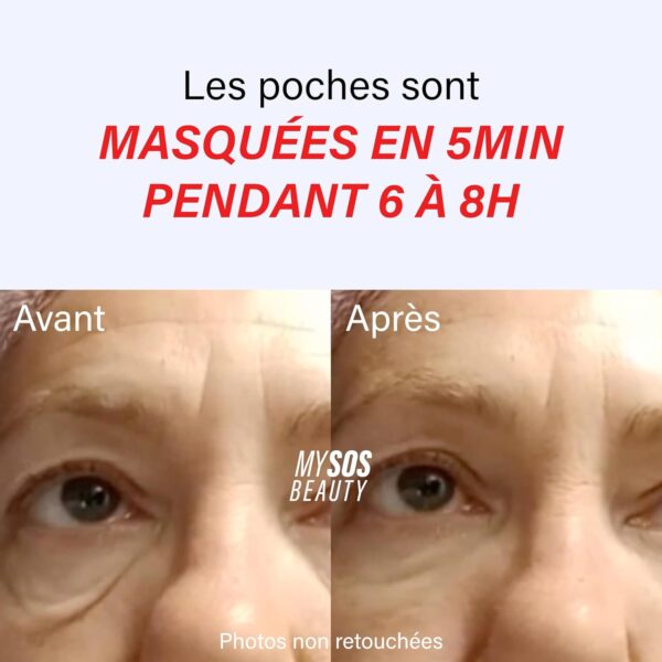 Gel liftant instantané – Image 7