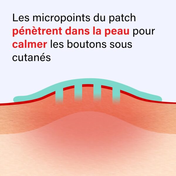 Kit complet SOS PATCHS Boutons – MYSOSBEAUTY – Image 2